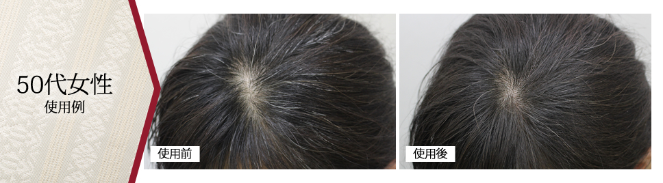 50代女性 使用例