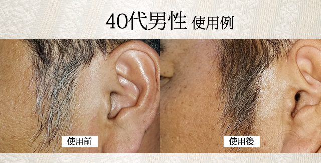 40代男性 使用例