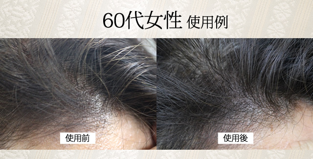 60代女性 使用例